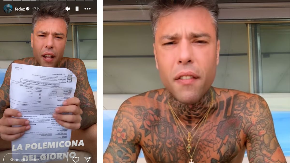 Fedez mostra su Instagram il referto dell’ospedale e sbeffeggia i giornalisti