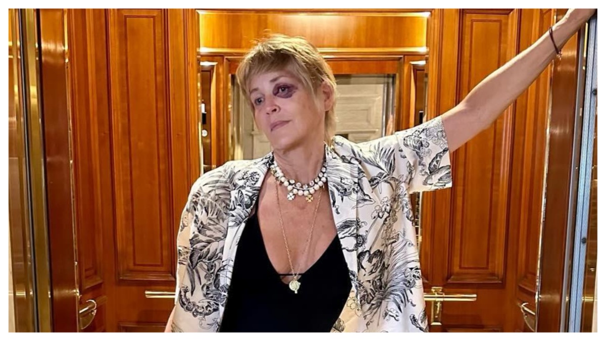 Sharon Stone con un occhio nero su Instagram