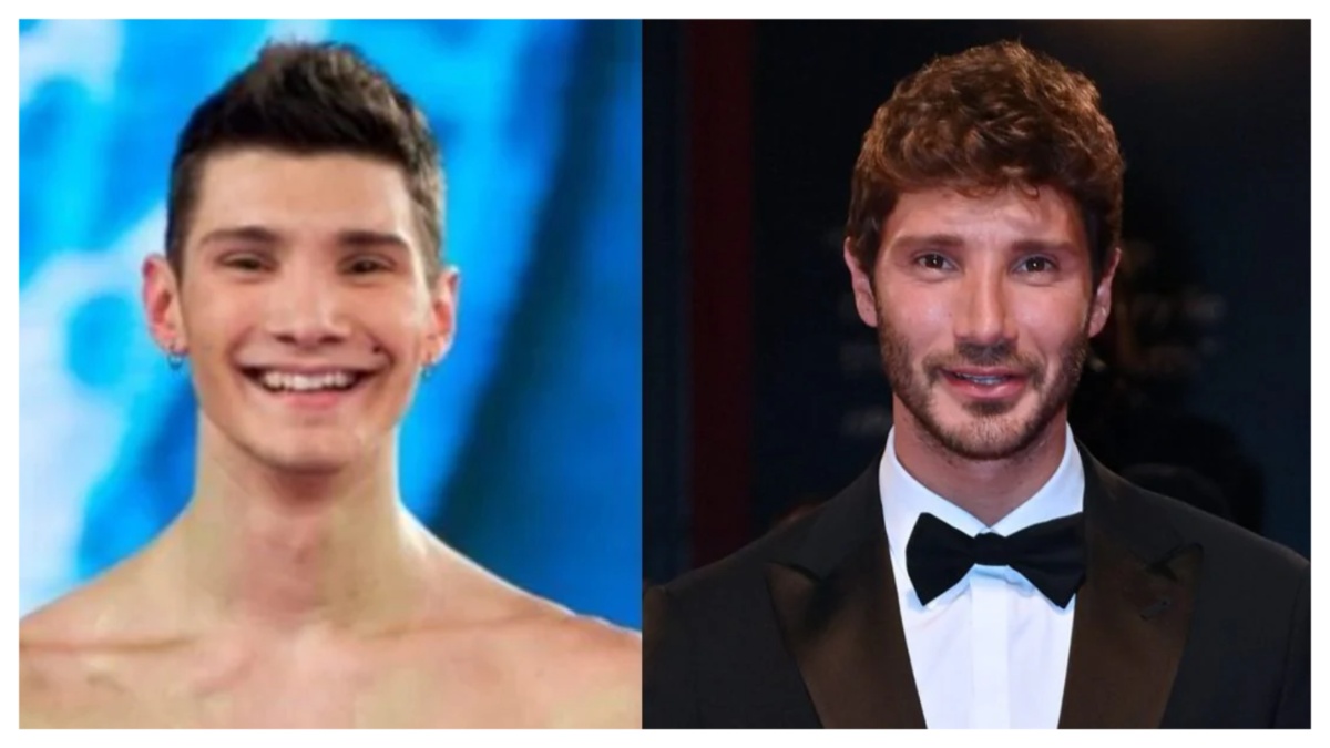 Giacomo Urtis: “Stefano De Martino prima e dopo i ritocchini. Non si è rifatto solo il naso”