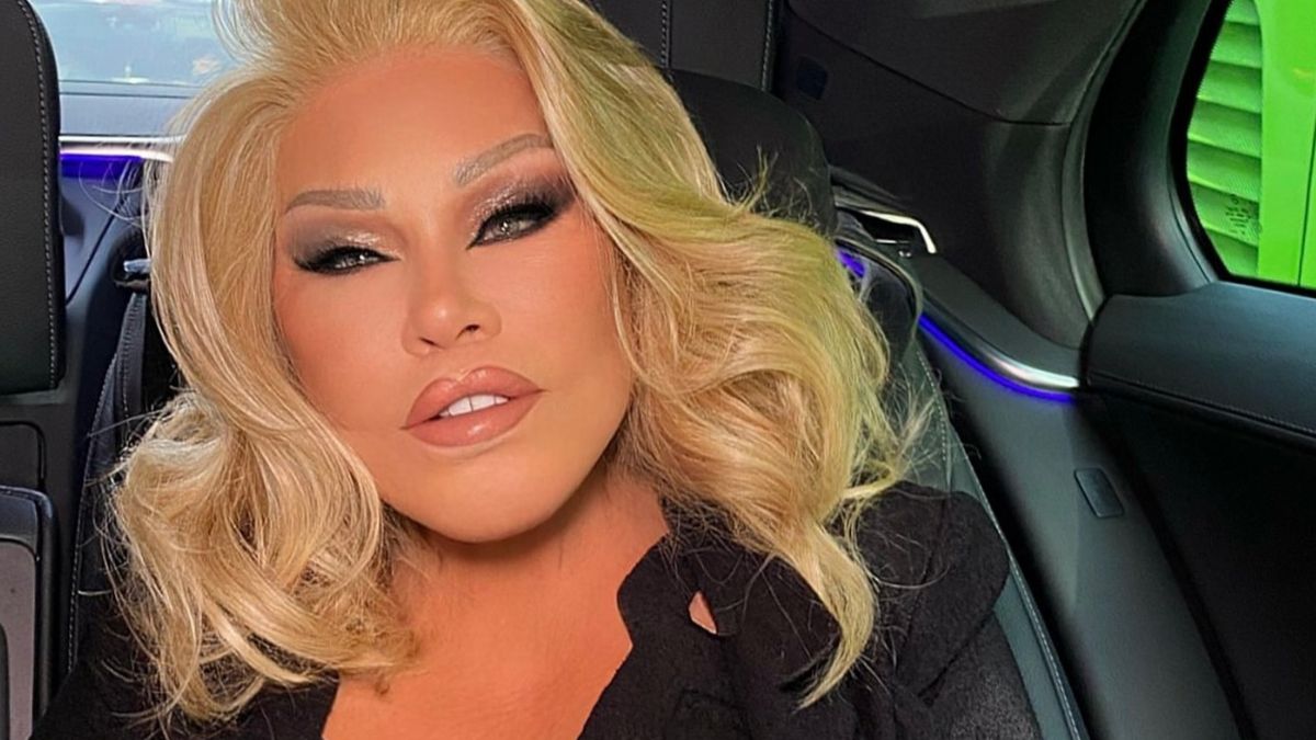 Morta la donna gatto, Jocelyn Wildenstein aveva 84 anni: l’annuncio del compagno